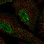 Anti-PHF1 Antibody