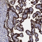Anti-SERPINB2 Antibody