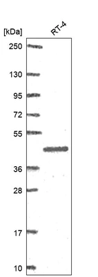Western blot analysis in human cell line RT-4.