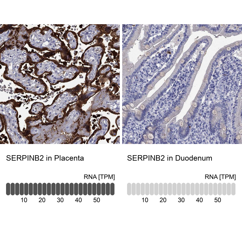 Anti-SERPINB2 Antibody