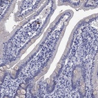 Immunohistochemical staining of human duodenum shows low expression as expected.