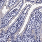 Immunohistochemical staining of human duodenum shows low expression as expected.