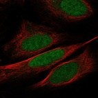 Anti-WDR5 Antibody