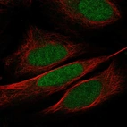 Anti-WDR5 Antibody