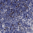 Anti-E2F8 Antibody