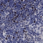Anti-E2F8 Antibody