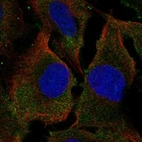 Anti-SYPL2 Antibody