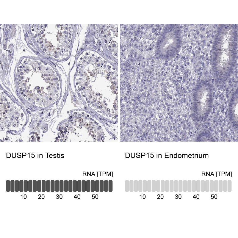 Anti-DUSP15 Antibody