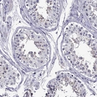Immunohistochemical staining of human testis shows high expression.