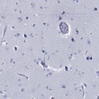 Immunohistochemical staining of human cerebral cortex shows low expression as expected.