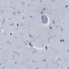 Immunohistochemical staining of human cerebral cortex shows low expression as expected.