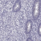 Immunohistochemical staining of human endometrium shows low expression as expected.