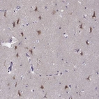 Immunohistochemical staining of human cerebral cortex shows high expression.
