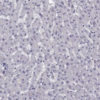 Anti-LRFN2 Antibody