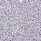 Immunohistochemical staining of human liver shows low expression as expected.