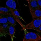 Immunofluorescent staining of human cell line SH-SY5Y shows localization to vesicles.