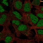 Anti-HMGXB4 Antibody