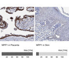 Anti-MPP1 Antibody