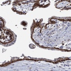 Immunohistochemical staining of human placenta shows high expression.