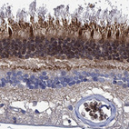 Immunohistochemical staining of human retina shows strong cytoplasmic positivity in photoreceptor cells and outer plexiform layer.