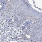 Immunohistochemical staining of human skin shows low expression as expected.