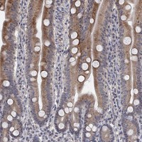 Anti-UNC5B Antibody