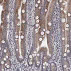 Anti-UNC5B Antibody