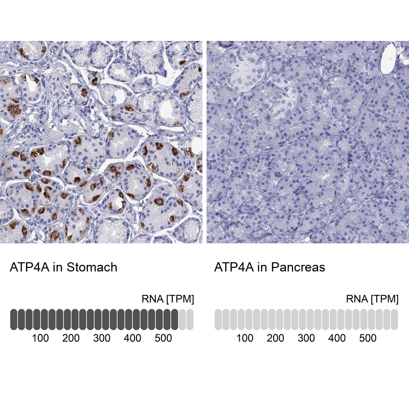 Anti-ATP4A Antibody