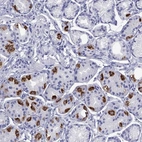 Immunohistochemical staining of human stomach shows high expression.