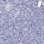 Immunohistochemical staining of human pancreas shows low expression as expected.