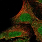 Immunofluorescent staining of human cell line U-2 OS shows localization to nucleoplasm & cytosol.