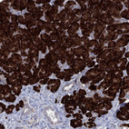 Immunohistochemical staining of human pancreas shows strong membranous-cytoplasmic positivity in exocrine glandular cells.