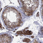 Immunohistochemical staining of human testis shows moderate membranous-cytoplasmic positivity in cells in seminiferous ducts and leydig cells.