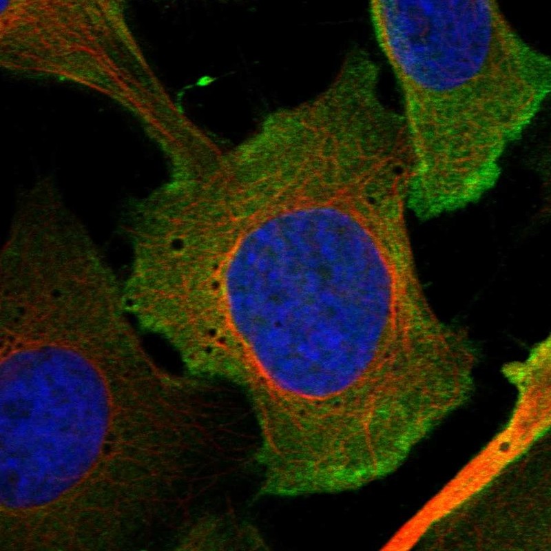 Anti-LEMD1 Antibody