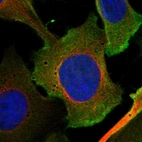 Anti-LEMD1 Antibody