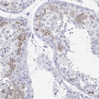 Immunohistochemical staining of human testis shows high expression.