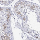 Immunohistochemical staining of human testis shows high expression.