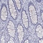 Immunohistochemical staining of human rectum shows low expression as expected.