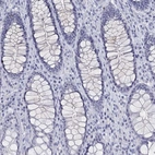 Immunohistochemical staining of human rectum shows low expression as expected.