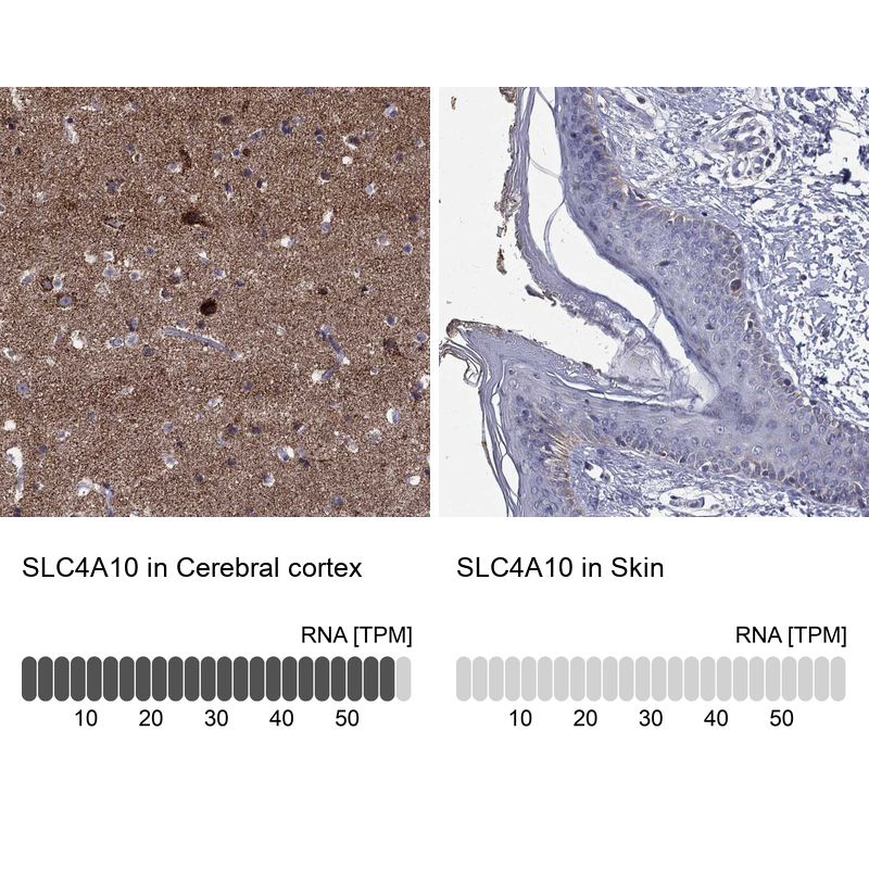 Anti-SLC4A10 Antibody