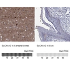 Anti-SLC4A10 Antibody