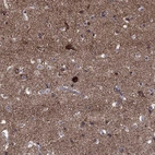 Immunohistochemical staining of human cerebral cortex shows high expression.