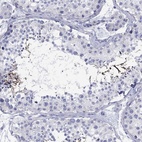 Immunohistochemical staining of human testis shows high expression.