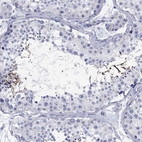Immunohistochemical staining of human testis shows high expression.
