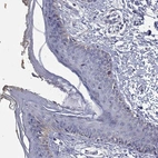 Immunohistochemical staining of human skin shows low expression as expected.