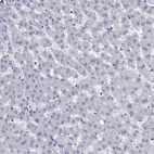 Immunohistochemical staining of human liver shows low expression as expected.