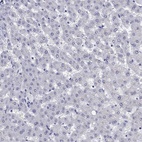 Anti-SH2D7 Antibody