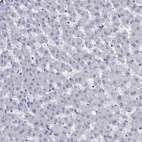 Immunohistochemical staining of human liver shows low expression as expected.