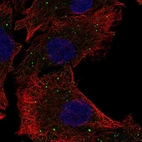 Anti-PAQR5 Antibody