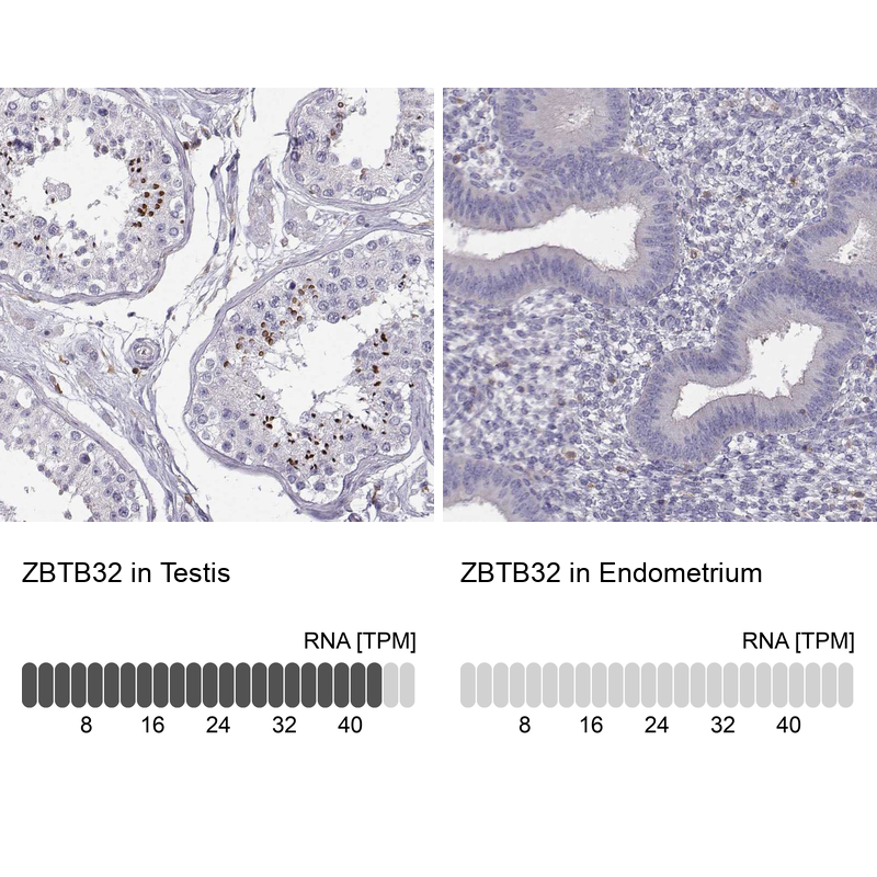 Anti-ZBTB32 Antibody